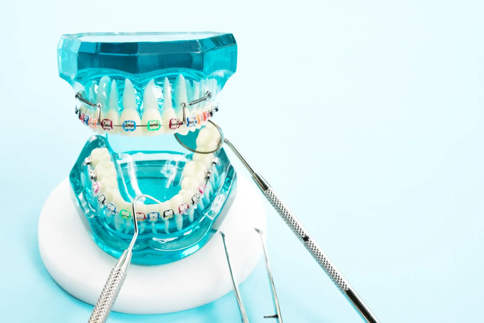 What to Know Before Getting Braces